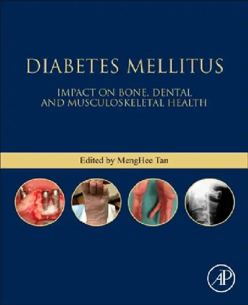 Diabetes Mellitus: Impact on Bone, Dental and Musculoskeletal Health by Meng Hee Tan