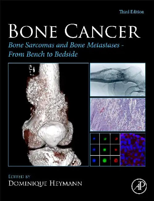 Bone Cancer: Bone Sarcomas and Bone Metastases - From Bench to Bedside by Heymann