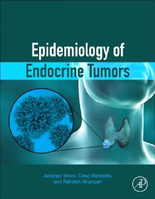 Epidemiology of Endocrine Tumors by Jahangir Moini