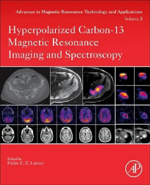 Hyperpolarized Carbon-13 Magnetic Resonance Imaging and Spectroscopy by Peder Larson