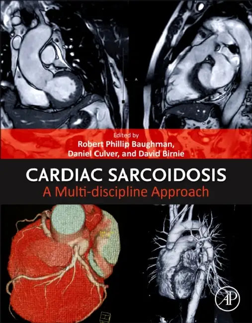 Cardiac Sarcoidosis: A Multi-Discipline Approach by Robert Phillip Baughman