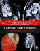 Cardiac Sarcoidosis: A Multi-Discipline Approach by Robert Phillip Baughman