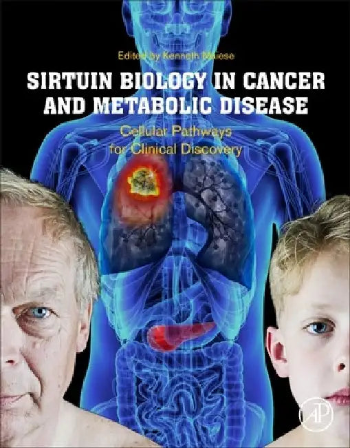 Sirtuin Biology in Cancer and Metabolic Disease: Cellular Pathways for Clinical Discovery by Kenneth Maiese