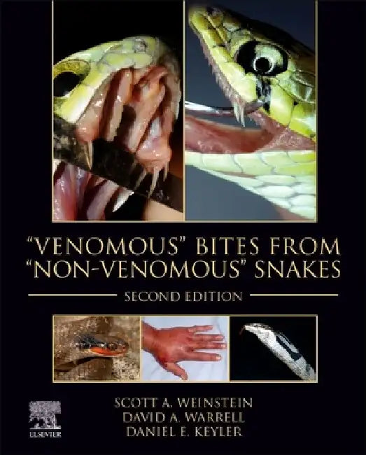 "Venomous" Bites from "Non-Venomous" Snakes by Scott A. Weinstein