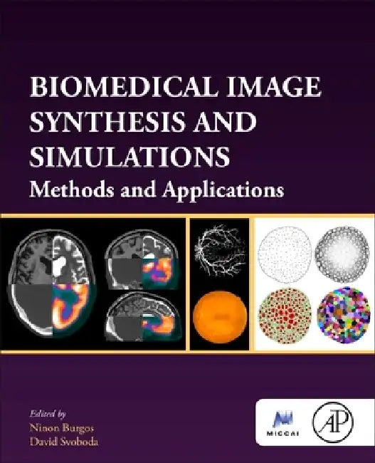 Biomedical Image Synthesis and Simulation: Methods and Applications by Ninon Burgos