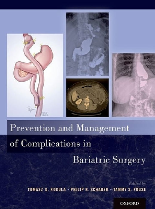 Prevention and Management of Complications in Bariatric Surgery by Tomasz G. Rogula, Philip R. Schauer, Tammy Fouse