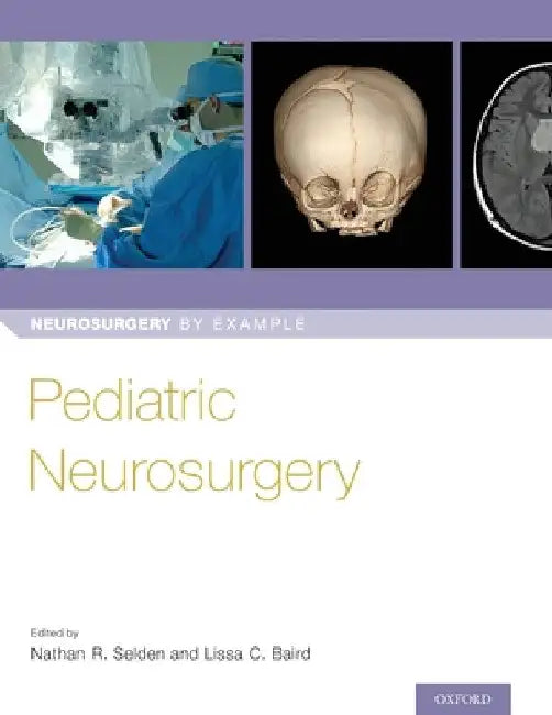 Pediatric Neurosurgery by Nathan Selden