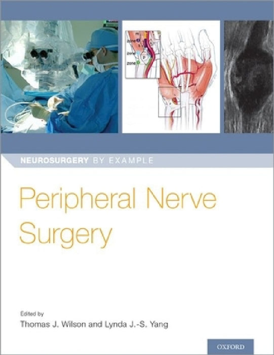 Peripheral Nerve Surgery by Thomas Wilson, Lynda J. Yang