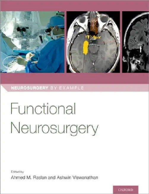 Functional Neurosurgery by Ahmed Raslan