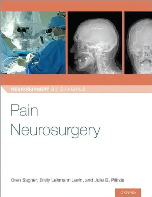 Pain Neurosurgery by Oren Sagher