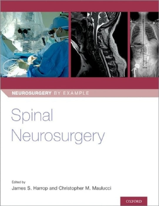 Spinal Neurosurgery by James Harrop, Christopher Maulucci
