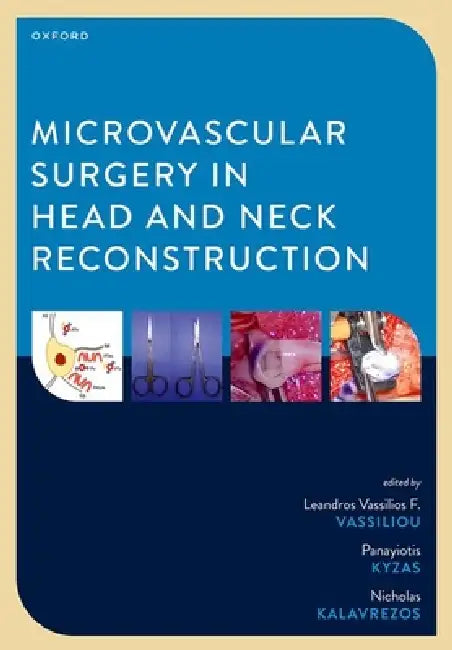 Microvascular Surgery in Head and Neck Reconstruction by Leandros Vassilios F. Vassiliou, Panayiotis Kyzas, Nicholas Kalavrezos