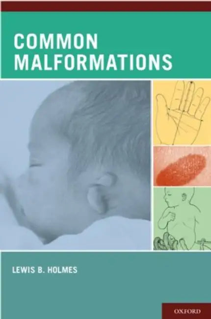 Common Malformations by Lewis B. Holmes