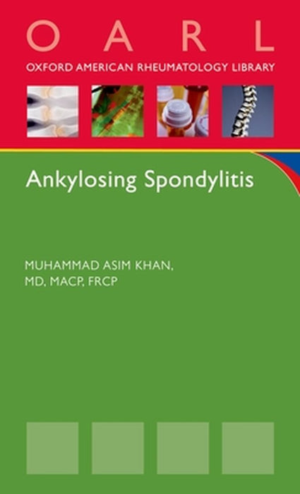ANKYLOSING SPONDYLITIS by KHAN MUHAMMAD ASIM