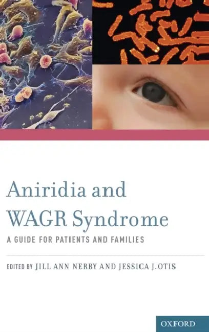 Aniridia and WAGR Syndrome: A Guide for Patients and Families [With CDROM] by Jill Ann Nerby, Jessca Otis