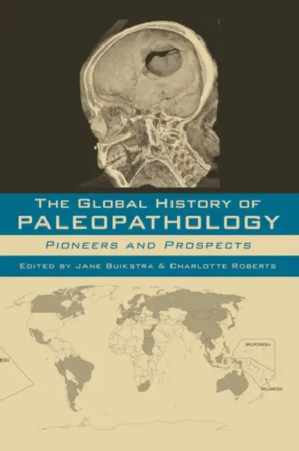 The Global History of Paleopathology: Pioneers and Prospects by Jane Buikstra, Charlotte Roberts