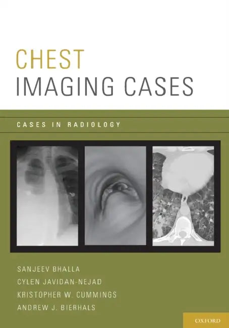 Chest Imaging Cases by Sanjeev Bhalla, Cylen Javidan-Nejad, Kristopher W. Cummings