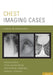 Chest Imaging Cases by Sanjeev Bhalla, Cylen Javidan-Nejad, Kristopher W. Cummings
