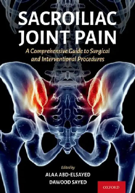 Sacroiliac Joint Pain: A Comprehensive Guide to Interventional and Surgical Procedures by Alaa Abd-Elsayed