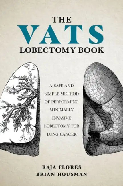 The Vats Lobectomy Book: A Safe and Simple Method of Performing Minimally Invasive Lobectomy for Lung Cancer by Brian Housman, Raja Flores