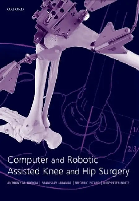 Computer and Robotic Assisted Hip and Knee Surgery by Anthony M. Digioia, Branislav Jaramaz, Frederic Picard