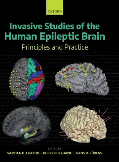 Invasive Studies of the Human Epileptic Brain: Principles and Practice by Samden D. Lhatoo, Philippe Kahane, Hans O. Luders