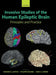 Invasive Studies of the Human Epileptic Brain: Principles and Practice by Samden D. Lhatoo, Philippe Kahane, Hans O. Luders