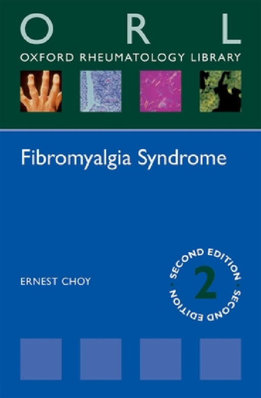 Fibromyalgia Syndrome by Ernest Choy