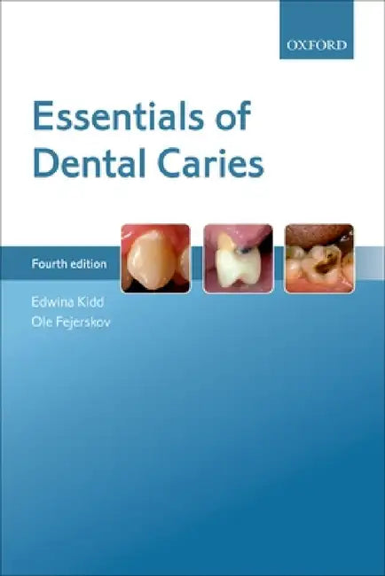 Essentials of Dental Caries 4e P by Kidd