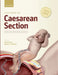 Textbook of Caesarean Section by Eric Jauniaux