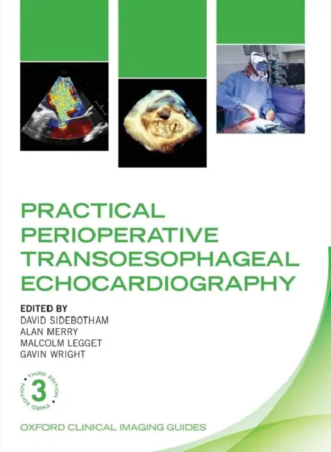 Practical Perioperative Transoesophageal Echocardiography by David Sidebotham