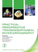 Practical Perioperative Transoesophageal Echocardiography by David Sidebotham