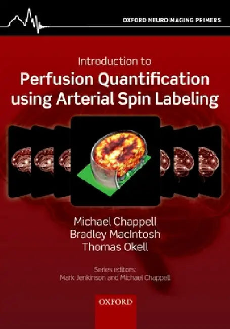 Introduction to Perfusion Quantification Using Arterial Spin Labelling by Michael Chappell, Bradley Macintosh, Thomas Okell