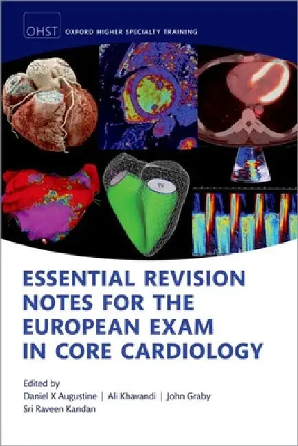 Essential Revision Notes for the European Exam in Core Cardiology by Daniel X. Augustine, John Graby, Ali Khavandi