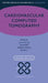 Cardiovascular Computed Tomography by James Stirrup