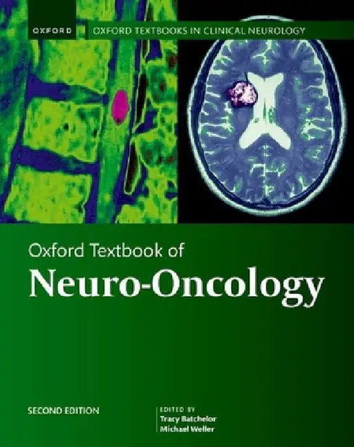 Oxford Textbook of Neuro-Oncology by Tracy Batchelor