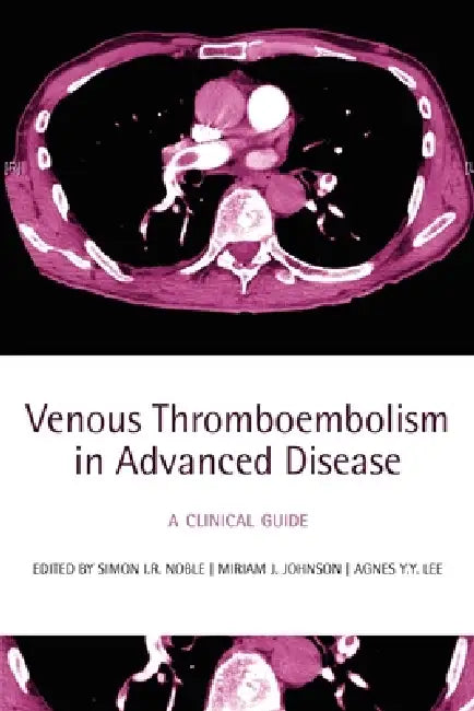 Venous Thromboembolism in Advanced Disease: A Clinical Guide by Simon I. R. Noble, Miriam J. Johnson, Agnes Y. Y. Lee
