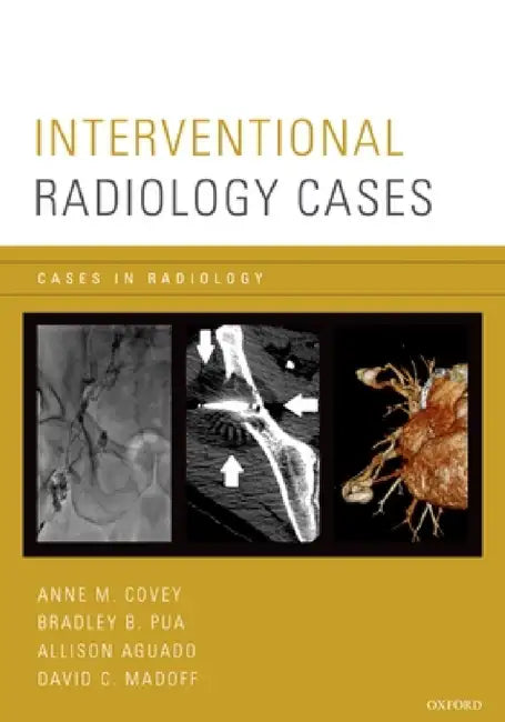 Interventional Radiology Cases by Anne M. Covey, Bradley Pua, Allison Aguado