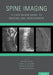 Spine Imaging: A Case-Based Guide to Imaging and Management by Shivani Gupta, Daniel M. Sciubba, Mark M. Mikhael