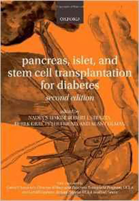 Pancreas, Islet And Stem Cell Transplantation For Diabetes