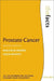 Prostate Cancer by Malcolm Mason