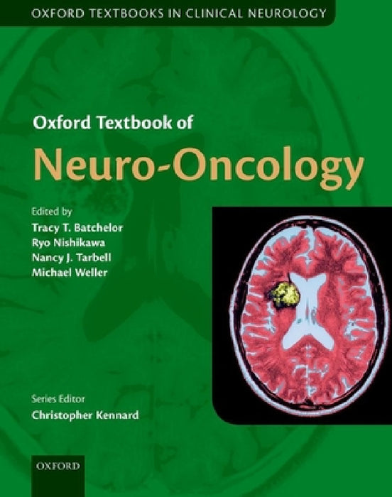Oxford Textbook of Neuro-Oncology by Tracy Batchelor