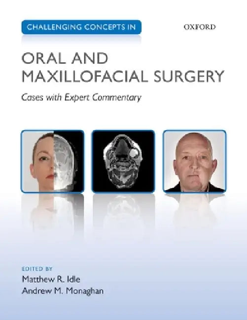 Challenging Concepts in Oral and Maxillofacial Surgery: Cases with Expert Commentary by Matthew Idle, Andrew Monaghan