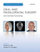 Challenging Concepts in Oral and Maxillofacial Surgery: Cases with Expert Commentary by Matthew Idle, Andrew Monaghan