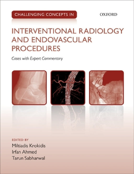 Challenging Concepts in Interventional Radiology by Miltiadis Krokidis, Irfan Ahmed, Tarun Sabharwal