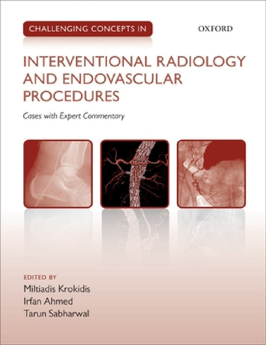 Challenging Concepts in Interventional Radiology by Miltiadis Krokidis, Irfan Ahmed, Tarun Sabharwal