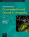 Oxford Textbook of Osteoarthritis and Crystal Arthropathy by Edited By Doherty Bijlsma