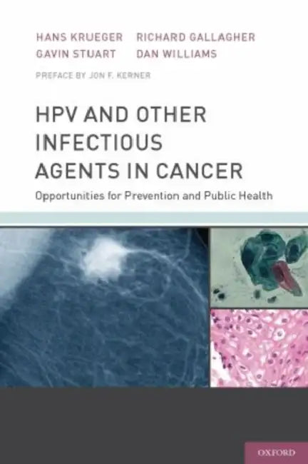 Hpv and Other Infectious Agents in Cancer: Opportunities for Prevention and Public Health by Hans Krueger