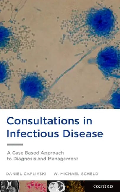 Consultations in Infectious Disease: A Case Based Approach to Diagnosis and Management by Daniel Caplivski, W. Michael Scheld