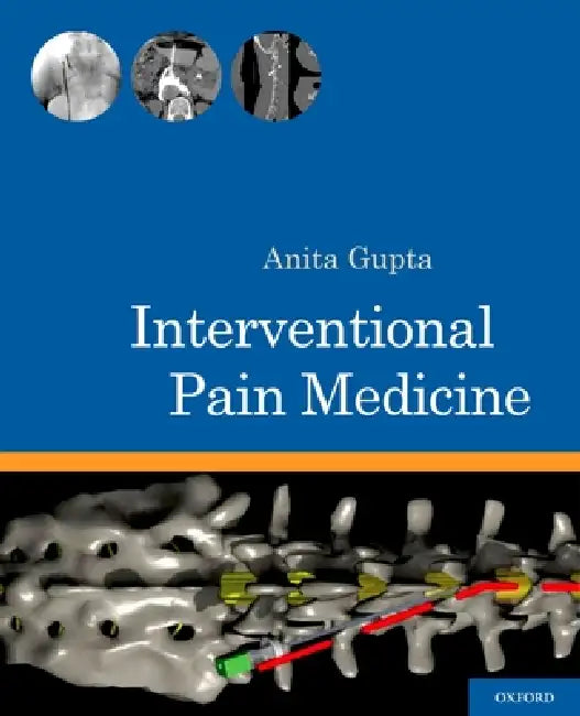 Interventional Pain Medicine by Anita Gupta